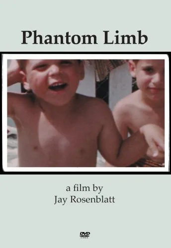 Ból po utraconej nodze