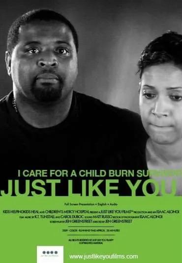Just Like You: I Care for a Child Burn Survivor
