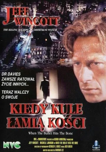 Kiedy kule łamią kości