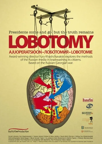 Lobotoomia