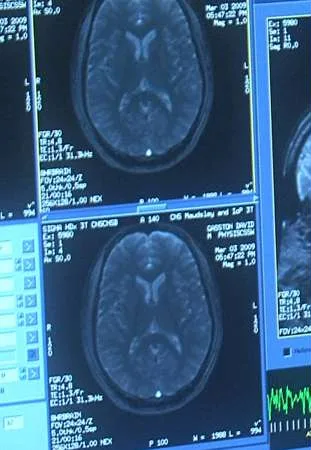 Neuromarketing. Mózg pod presją