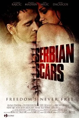 Serbian Scars
