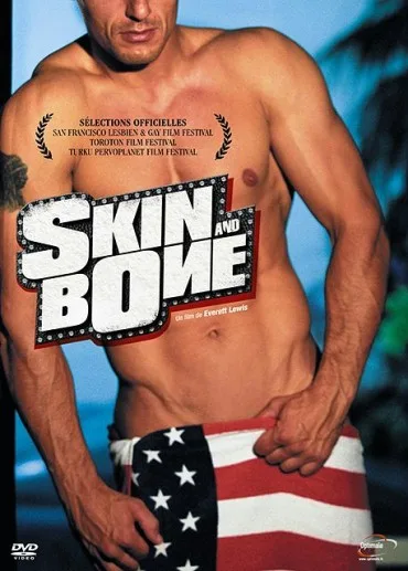 Skin and Bone
