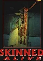 Skinned Alive