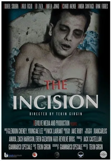 The Incision