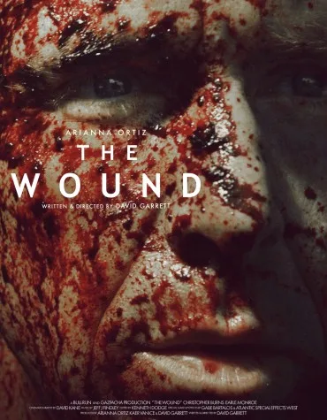 The Wound