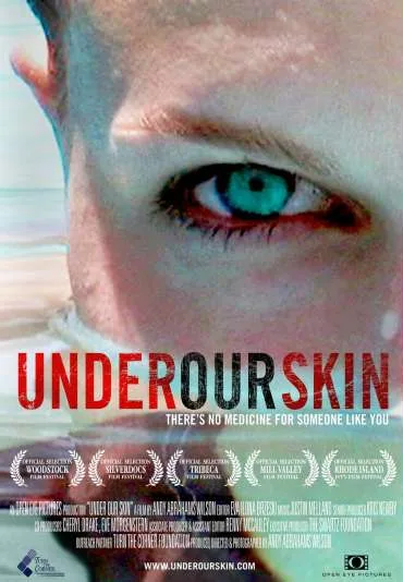 Under Our Skin